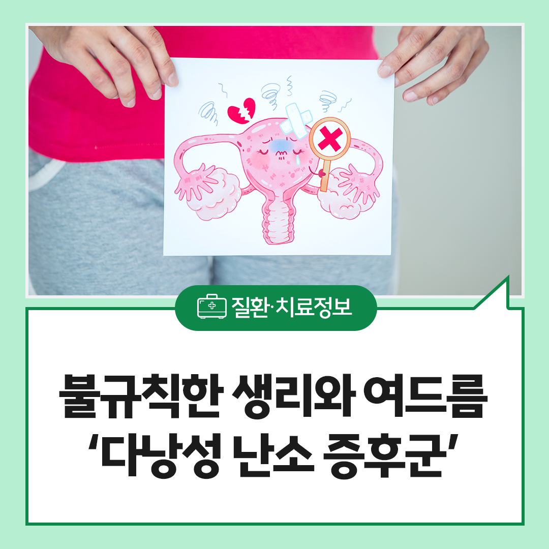 �ұ�Ģ�� ����, ���帧�� Ȥ�� ���ٳ��� ���� ���ı��� ��ȣ�ϱ�?