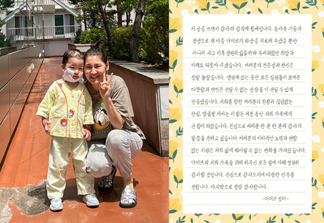 몽골 화상환아 무료초청 수술_다미르